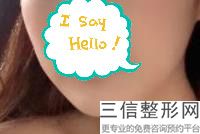 玻尿酸丰唇会不会变形(玻尿酸丰唇会不会变形呢)