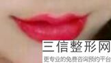 玻尿酸丰唇肿胀怎么办(玻尿酸丰唇肿胀怎么办呢)