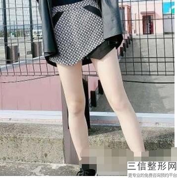 大腿抽脂什么时候能看到效果(大腿抽脂什么时候能看到效果,腿粗了)
