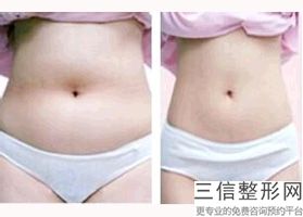 丰胸(丰胸比较有效比较天然的方法)