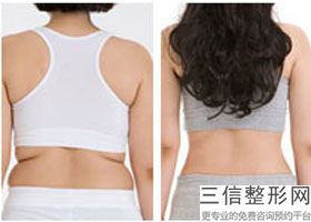 丰胸医院排名前十(丰胸医院排名前十名)