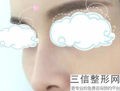 韩国进口硅胶假体隆鼻多少钱(韩国进口硅胶假体隆鼻多少钱啊)