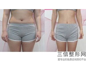 怎样才可以有效丰胸(怎样才可以有效丰胸呢)