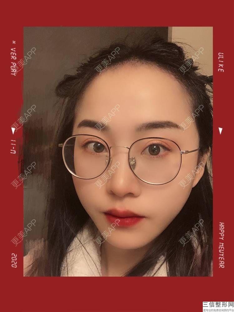 种植头发可以吗(种植头发可以吗女生)