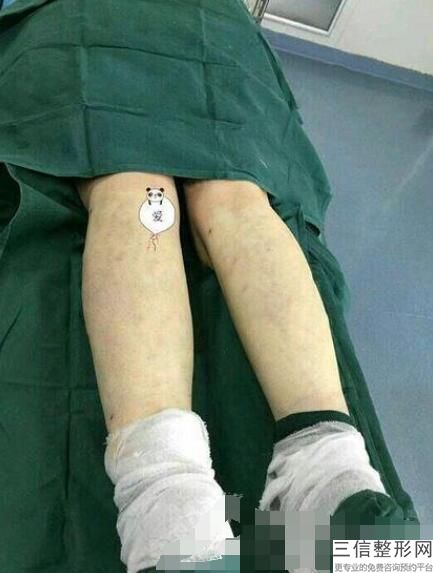自然有效的丰胸办法(瘦的人怎么丰胸比较快)