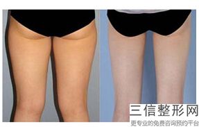 良好的丰胸医院美容(男士丰胸医院)