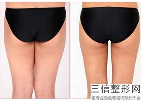 按摩丰胸的手法有哪些