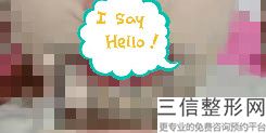 玻尿酸丰唇要忌口吗多久