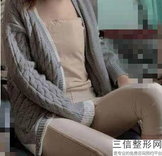 抽脂丰胸的危害有哪些