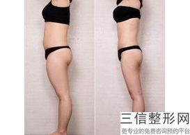 丰胸针多久打一次