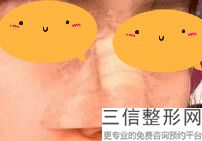 黑龙江瑞丽医疗美容医院能做假体隆鼻吗