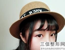 假体隆鼻的好处有哪些