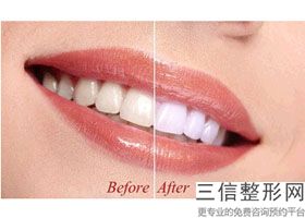 【盘点】厦门登特口腔医院正畸好的医生排名
