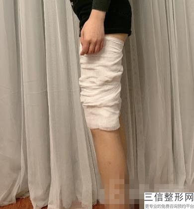 玻尿酸丰胸贵吗多少钱(玻尿酸丰胸贵吗多少钱一次)