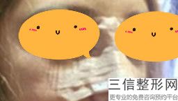 玻尿酸隆鼻多久见效果(玻尿酸隆鼻多久见效果啊)
