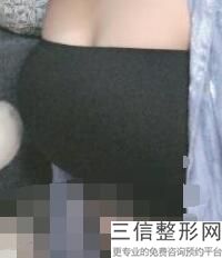 假体隆胸多久能跳舞(假体隆胸多久能跳舞健身)
