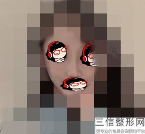 做鼻综合应该去哪里做好(做鼻综合应该去哪里做好呢)