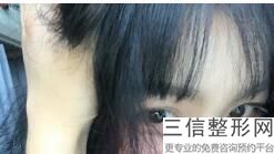 2023常州眼角提拉微整医疗整形医院前十榜单实力强悍,常州美丽阳光美容整形医院是技术流