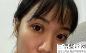 2023成都眼纹脂肪填充医疗整形医院口碑前十强近期公布！成都凯美鑫医疗美容门诊部公立、私立均人气很旺！