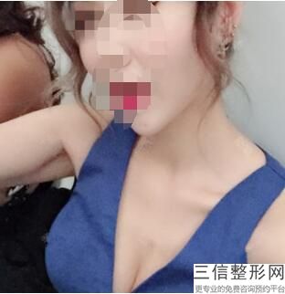 2023德州综合隆胸美容医院上榜清单前十公布必看！德州陵城区中医院医疗美容科口碑擅长、点评为大家全面解惑！