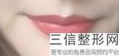 2023贵阳唇纹手术祛除上榜清单top10整形医院名单集结!贵阳旭美人整形美容门诊部口碑实力强劲
