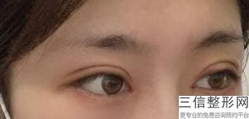 2023江西眼周综合美容正规医院评分十强口碑权威出炉了！江西九江风华整形美容门诊部榜一无争议！