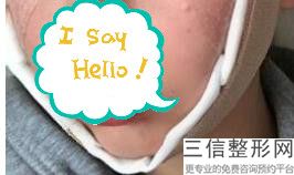 2023宁波唇综合整形正规医疗整形医院上榜前10名近期公布！宁波北仑美仁医疗美容医院实力稳居前三