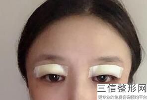 2023宁波眼尾静态纹整形医院TOP10强榜单全新榜单一览!宁波PHISKIN芙艾医疗美容医院大众认可度高