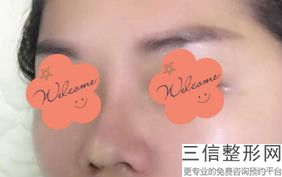 2023濮阳鼻翼肥厚塌鼻子整形医疗美容医院前10上榜清单推荐，河南濮阳整形美容外科门诊部专家大咖实力入围