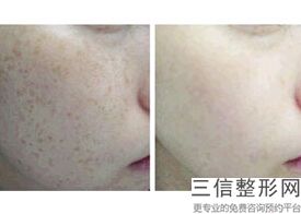 2023青岛脸部皮肤提拉在榜单前10名美容医院扒一扒！青岛伊美尔国斌整形外科医院业内数一数二