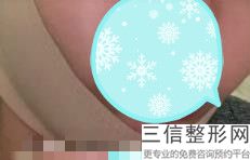 2023三亚电波拉皮祛唇纹医疗整形医院排名10强夏日巨献！三亚刘天顶医学整形诊所医院实力，技术亮点全解析