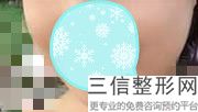 2023深圳唇纹去除法医院TOP10强口碑排名是哪几家？深圳爱氏医疗美容门诊部实力及招牌案例发布