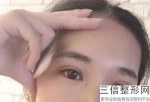 2023深圳眼部提拉紧致手术正规医疗整形医院上榜TOP10热门发布！深圳素美医疗美容诊所凭借实力稳住榜一