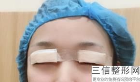 2023苏州线雕眼周十大美容医院排名榜实地考察！苏州美博士整形美容门诊部口碑不赖放心选择