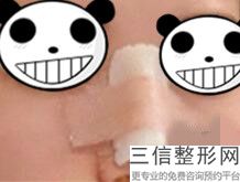 2023西安鼻翼削薄排行榜top10强整形美容医院能力公开！西安医学中心医院整形医院审美超前