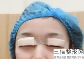 2023延吉秒雕祛眼角纹前十位的医疗整形医院刷新！延吉吉田医学整形润肤诊所私立医美有口皆碑