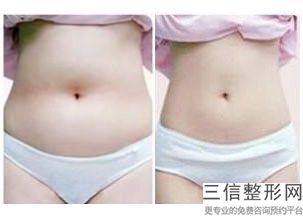 2023银川微精2C丰胸技术美容医院在榜名单前十强人气机构！宁夏银川维多利亚医疗美容医院口碑优良，值得选择！