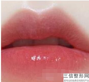2023重庆冰点脱唇毛精选医院资质解答！重庆亚太整形医院实力可查