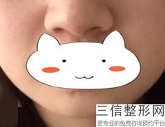 长沙唇色暗黑漂唇经验丰富的整形美容医院是哪家(长沙唇色暗黑漂唇口碑排名前10位美容医院)