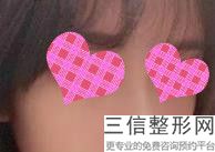 大连肉毒素鼻头缩小整形美容医院比较权威的有哪些个(大连肉毒素鼻头缩小美容医院前10名口碑排行)