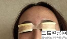 东莞微雕去眼周纹医院性价比高的有哪些家(东莞微雕去眼周纹正规美容医院口碑前十名)