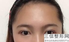 南京眼部脂肪医疗美容医院口碑反馈好的有哪些家(南京眼部脂肪医院前10名)