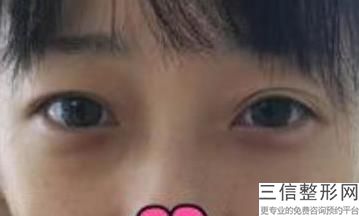 宁波去除纹眼线整形医院推荐度高的有哪些家(宁波去除纹眼线榜上top10医疗美容医院)