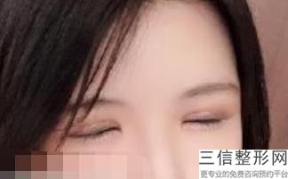 宁波眼鼻部修复哪里的医院口碑好(宁波眼鼻部修复大型美容医院排行)