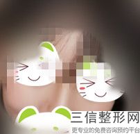 厦门复合彩光嫩肤治疗鼻唇沟纹医院哪些值得去(厦门复合彩光嫩肤治疗鼻唇沟纹整形美容医院TOP10排名)
