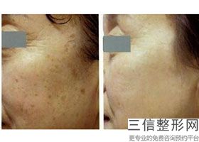 深圳改善皮肤问题整形美容医院都有哪些口碑反馈好的(深圳改善皮肤问题正规医疗整形医院评价前十强)