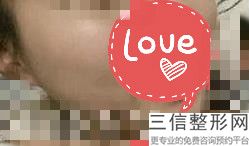 烟台嘴角上扬好的医院哪个比较好(烟台嘴角上扬美容医院前10名排名)
