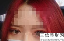 郑州激光定位双眼睑反馈好的整形医院有哪些(郑州激光定位双眼睑排行榜top10医疗美容医院)