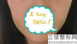 重庆玻尿酸填充鼻唇沟医疗美容医院哪个比较有名气(重庆玻尿酸填充鼻唇沟医疗整形医院精选前十名)